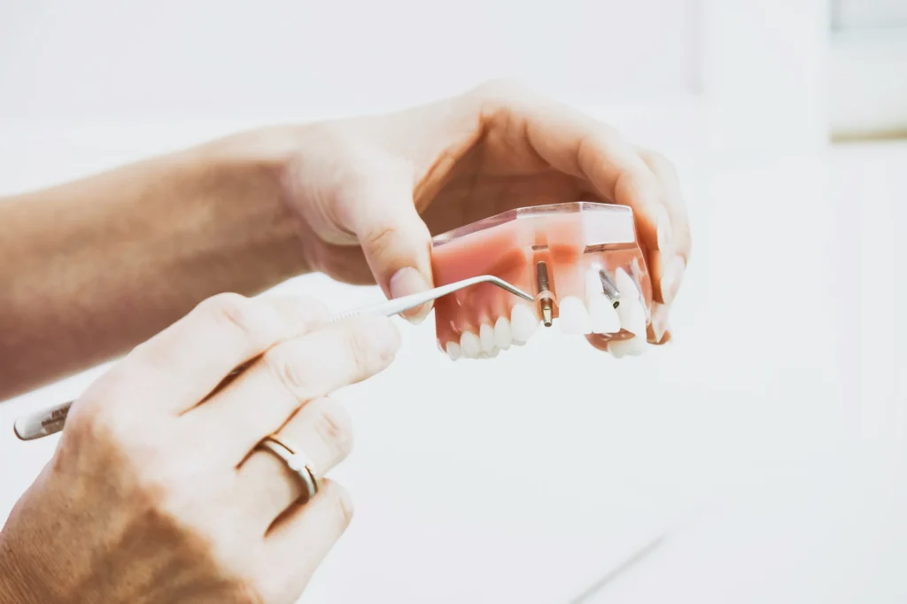 Cuáles son los beneficios de los tratamientos de estética dental