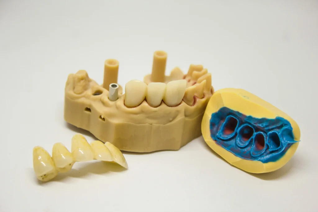 Tratamientos de Odontología General en Arturo Soria